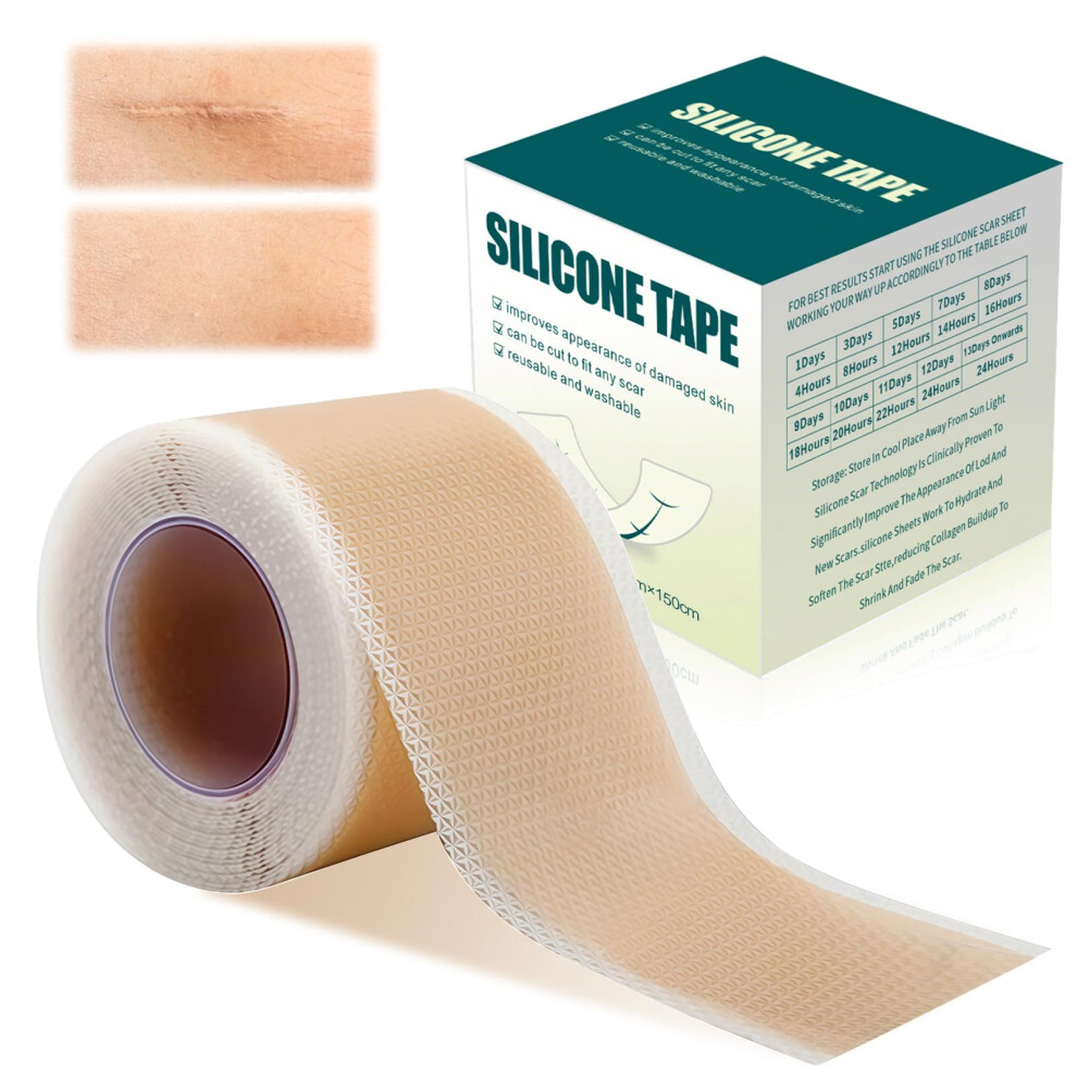 Nacerlary Silicone Scar Sheets, 1.6'' X 60''Roll-1.5M Premium Silicone Gel Scar Tape, Reusable Silicone Patches, Painless Silicone Tape Roll, Silicone Scar Tap