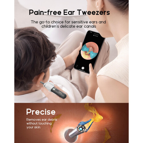 Bebird Earsight Plus Ear Wax Removal Tool Camera, Ear Cleaner with 2