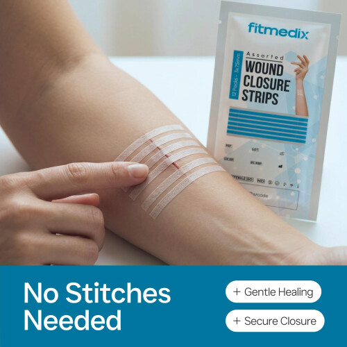 FitMedix Sterile Wound Closure Suture Strips Assorted - 4 Sizes (240 1