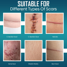 Silicone Scar Tape Medical Grade Silicone Scar Sheets | 4cm X 1.5m | Reusable Scar Tape Works On Old & New Scar Effective Treatment for Surgical Scar