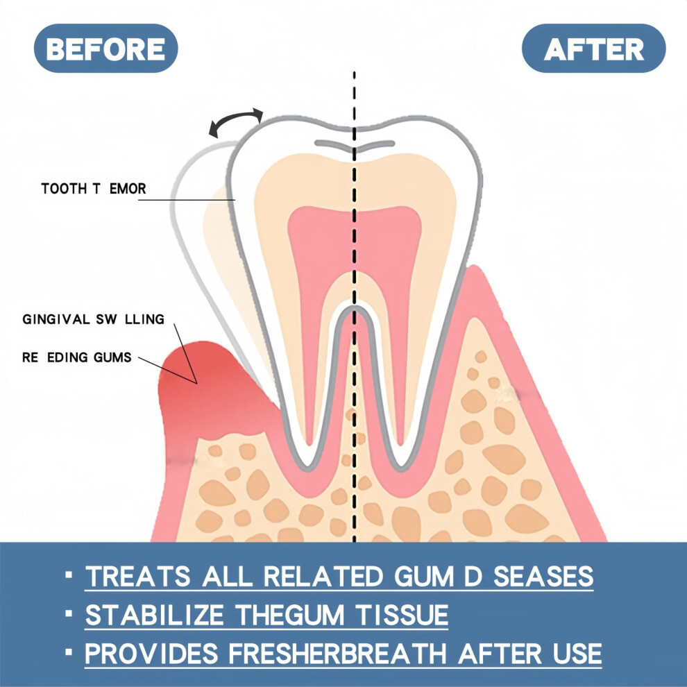 Nvbfol 2Pcs Mullend Gum Repair Gel,Natural Toothpaste Nursing,Gum Disease Treatment For Adults,Gu/M Protect Repair Gel For Receding Gums,Instant Whitening E