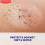 Elastoplast Elastoplast Spray Plaster for Wounds (40ml), Quick-Drying and Easy to 5