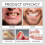 Full Denture Set, Upper and Lower False Teeth for Men Women, Perfect Fit 4