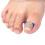 100pcs Toenail Correction Patch Glue Free Pedicure Tools Corrector Toe Nail Ingrown Patch 3