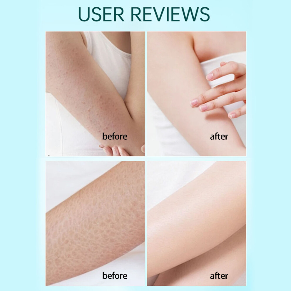 Exfoliating Washcloth Deeply Cleansing Back Acne Treatments Exfoliating Towel 2