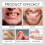 Full Denture Set, Upper and Lower False Teeth for Men Women, Perfect Fit 4
