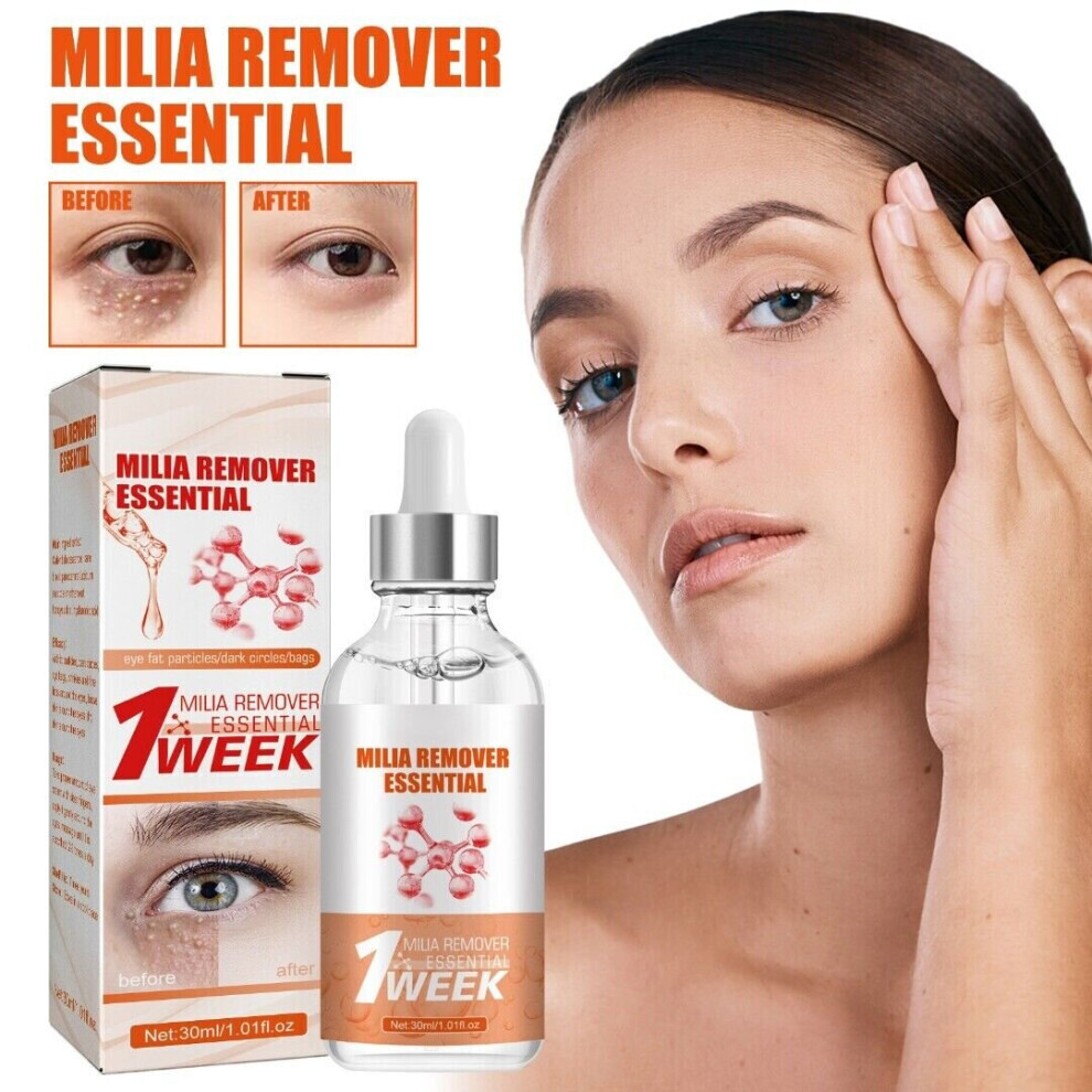 Milia Remover Serum Milia Spot Treatment Helps Dissolve and Reduce