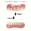 5pcs Set Upper Teeth   Lower Teeth   Transparent Case   Accessories. Not a Dental Veneer Kit. Suitable for Missing or 4