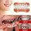 5pcs Set Upper Teeth   Lower Teeth   Transparent Case   Accessories. Not a Dental Veneer Kit. Suitable for Missing or 7