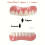 5pcs Set Upper Teeth   Lower Teeth   Transparent Case   Accessories. Not a Dental Veneer Kit. Suitable for Missing or 9