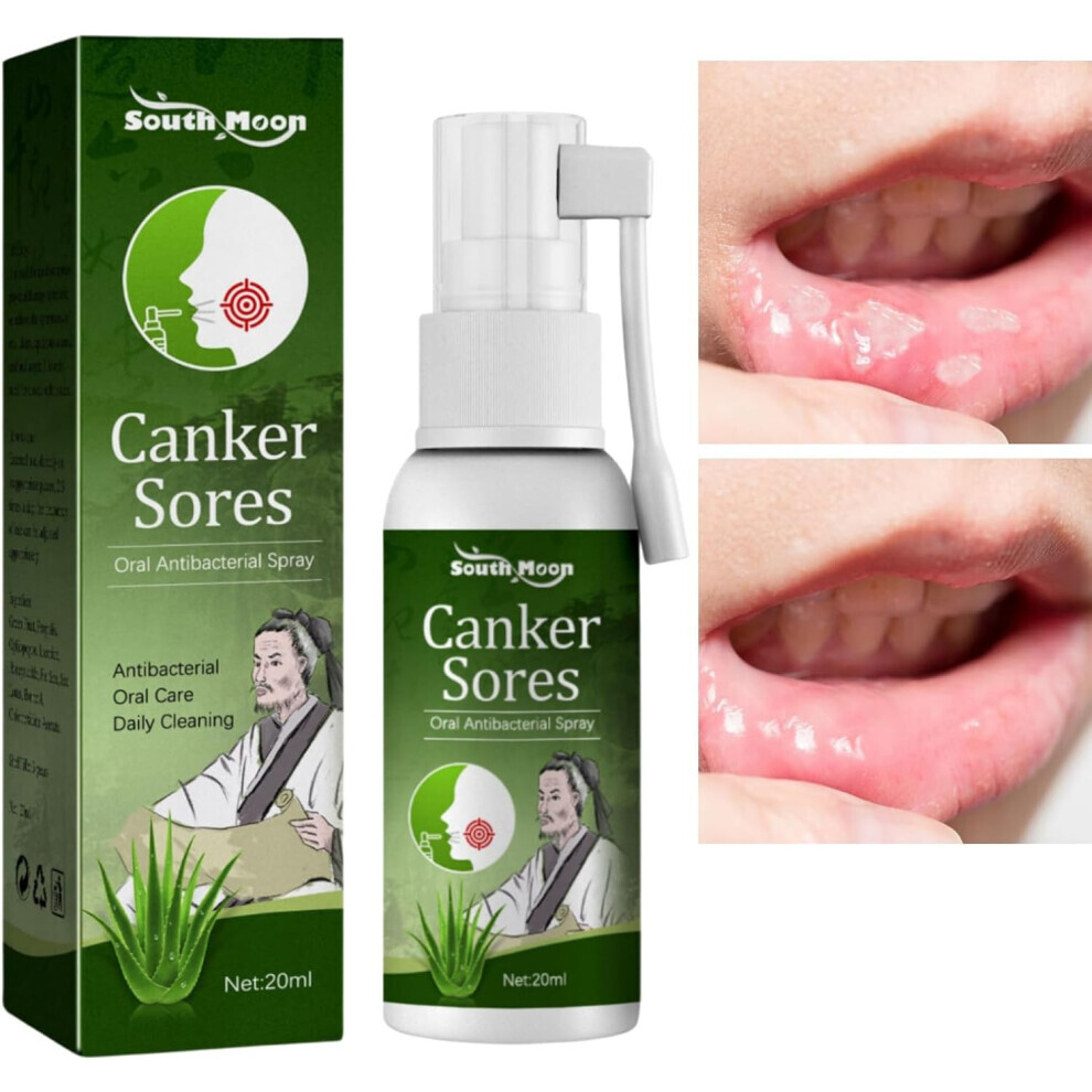 Mouth Ulcer Treatment Spray,Mouth Ulcer Spray,Mouth Ulcer Treatment for Adults,Canker Sore Treatment,Herbal Mouth Spray