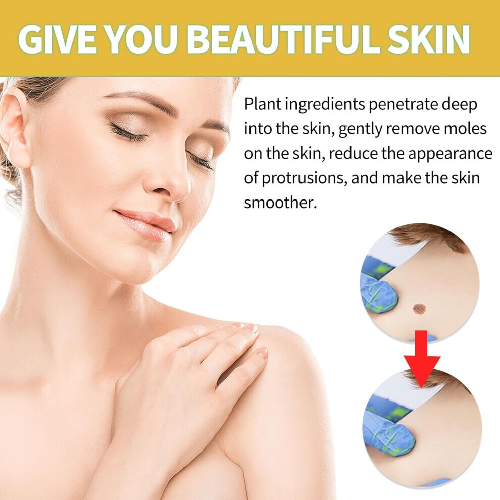 Stoyotu Cream Bee Venom Wart And Tag Remover,Bee Venom ,Tags And Mole Remover,Mole And Skin Tag Remover,Skin Wart Remover,Bee Venom Mole And Wart