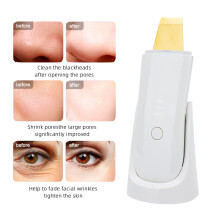 (White) Ultrasonic Skin Scrubber Face Spatula Facial Skin Exfoliator Scraper and Blackhead Remover Pore Cleaner Facial Deep Cleansing