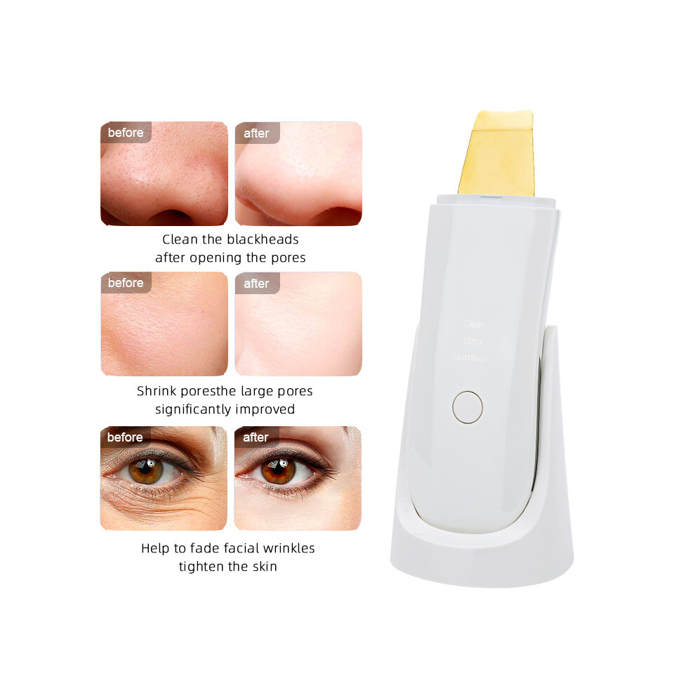 Stoyotu White (White) Ultrasonic Skin Scrubber Face Spatula Facial Skin Exfoliator Scraper And Blackhead Remover Pore Cleaner Facial Deep Cleansing
