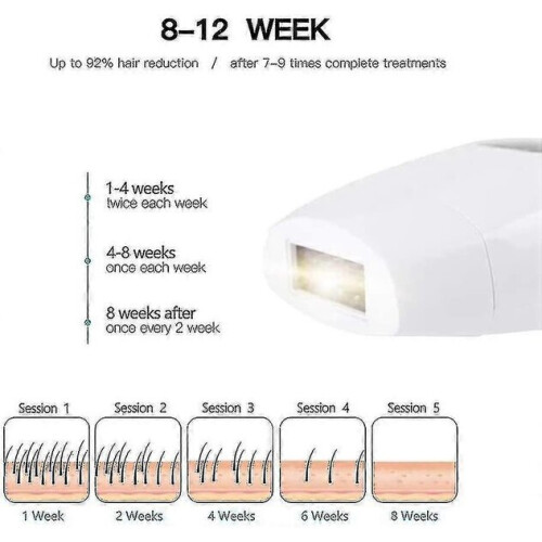 Ipl 600,000 Flash epilator, suitable for / face / bikini / / legs ( 2