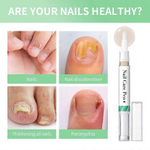 (2pcs) 1-5x Nail Care PenThe Original, Nail Fungus Pen Austria, Nail Care Pen Cosmetic Care for Nail Fungal Infection