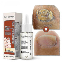 1/2/3PCS onychomycosis liquid concave and convex rough nail spot onychomycosis soft nail repair liquid finger edge oil nail repair liquid 20ML S04