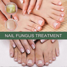 Extra Strong Nail Fungus Treatment, Best Nail Repair, Stop Fungal Growth, Effective for Cracked/Brittle Nails (10-50ml)