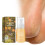 Moisturizing Foot Spray for Dry Heels 2