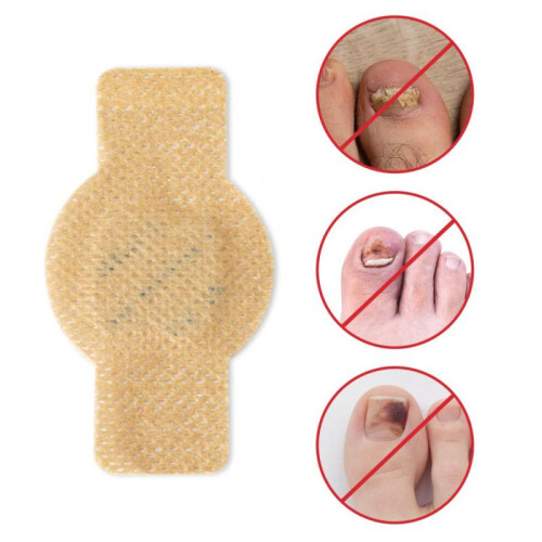 210Pcs Toenail  Patch Set with Secure Adhesive and Protective Coverage for Damaged Nails 1