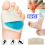 (M/L) (M/L) Metatarsal Gel Foot Pads Support Insoles Mens 1