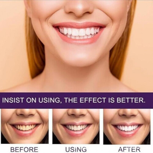 (10%) 7 Pro Strong Whitening Toothpaste Fresh Breath Stain Removal Mint 2
