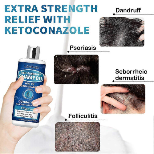 Anti-Dandruff Shampoo with 1% Ketoconazole, Fresh Scent,300ml