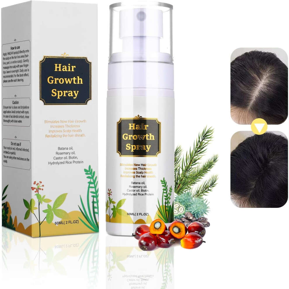 Gogerstar Natural Hair Growth Spray Nurturing Scalp, Hair Growth Serum With Batana Oil Rosemary Oil Castor Oil&Biotin, Effective Hair Thickening For Men Women