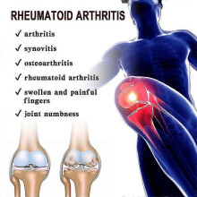 (10) Arthritis Pain Relief Ointment To Relieve Joint And Arthritis Pain Muscles Massage Cream Neuropathic Pain Back