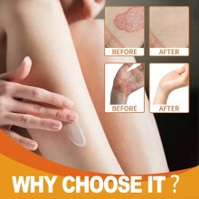 (5PCS, Multicolor) WIYUN 30g Bee Venom Psoriasis Dermatitis Cream Body Skin Moisturizing Care, WYA06-A008-30-WH1
