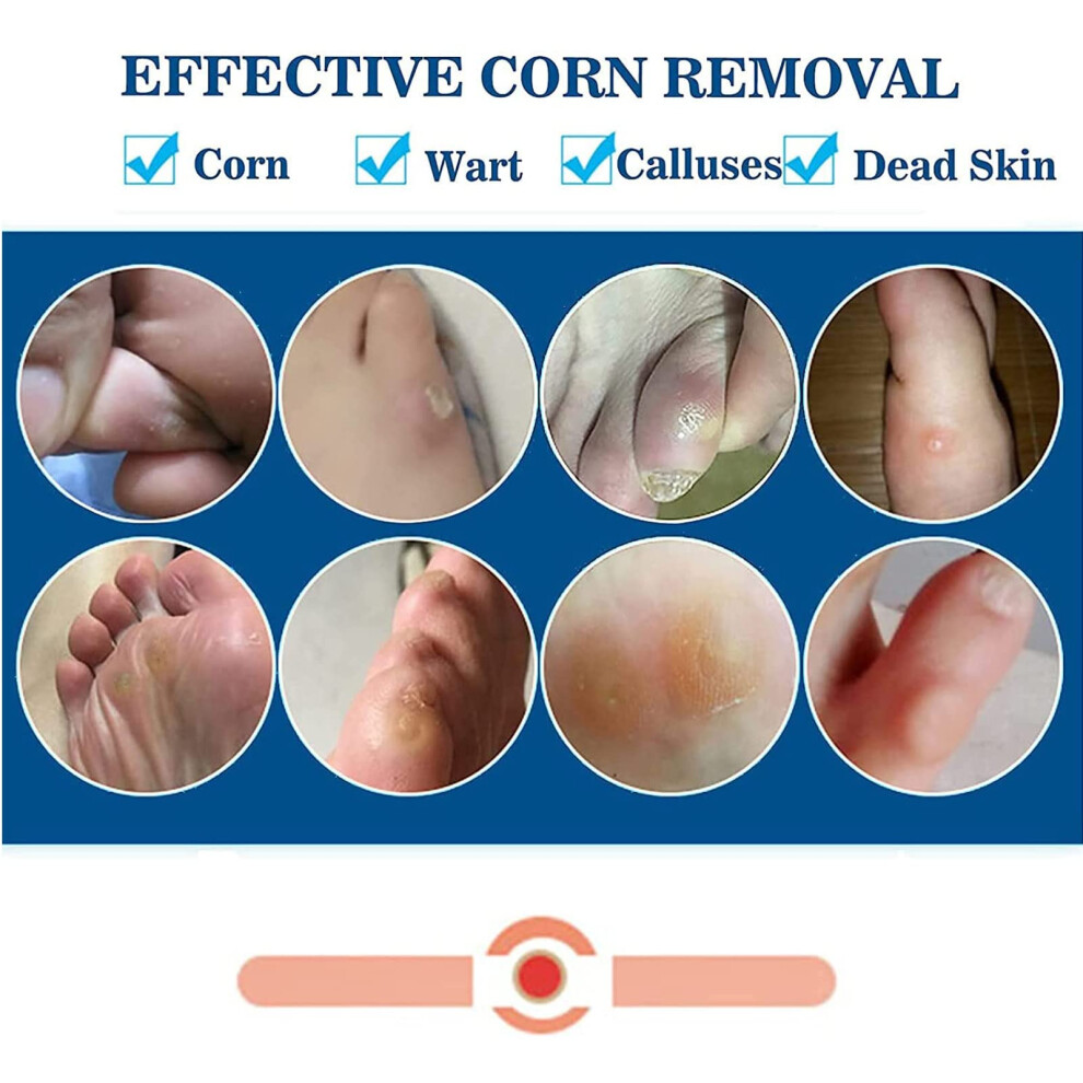Mq Corn Remover Pads, Wart Remover, Foot Corn Remover Patch, 48 Pcs Corn Removal Pads, Corn Removal Ideal For Relief Corn Pain And Foot Care, Corn Pl