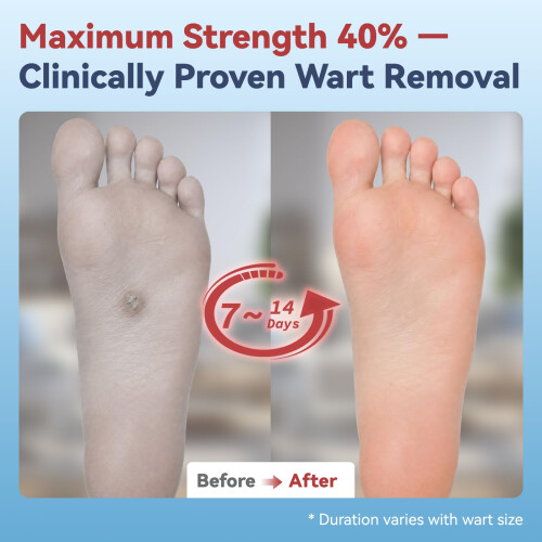 BPLXKUR Wart Remover Pads — Maximum-Strength OTC, Fast-Acting 1