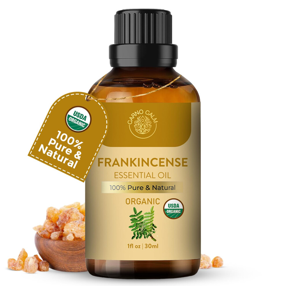 Carno Calm Frankincense Essential Oil 30Ml Â 100% Pure & Natural, Therapeutic Grade Boswellia Oil For Skin, Aromatherapy, Diffuser & Home Fragrance