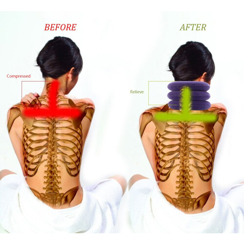 Cervical Neck Traction Device Inflatable Neck Stretcher, Use for Neck and Should 2