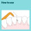 By Amazon Medium Reach Angled Interdental Brush 0.45mm 20pcs – 2 4