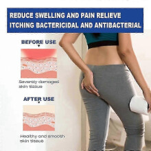 30g Hemorrhoid Remover Cream Removal Internal Piles Hemorrhoids Gel Natural Extract_caiyGj