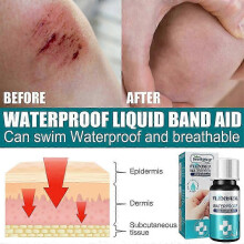 (2pcs) 1-3x 10ML Body Glue Medical Skin Adhesive Liquid Band First Aid Box Quick Firm Wounds