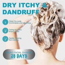 2X Seborrheic-Dermatitis Treatments Shampoo, Anti Dandruff Itch Control Hair Care Shampoo, for Men Women