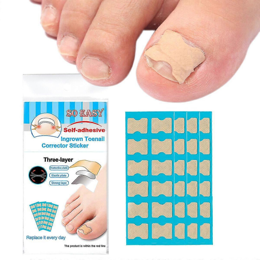 Toenail Correction Patch 36pcs, Pedicure Tools for Nail Care