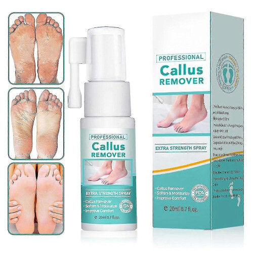 5g Professional Callus Remover Extra Strength Spray, Instant Foot Peeling Spray