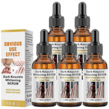 5pcs Strong Whitening Serum for Removing Dark Knuckle Finger Elbow And Knee