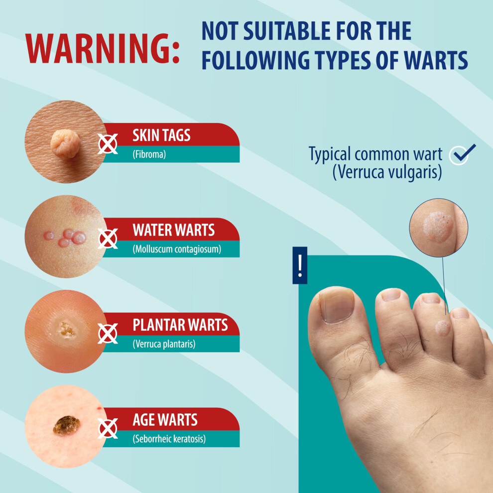 Behrend Homecare Behrend Wart Remover - Treatment For Common Warts For Hand & Feet