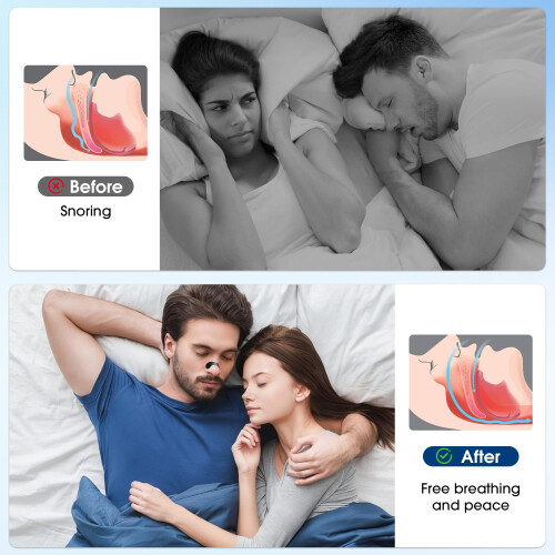 Nasal Strips 90 Pieces, Extra Strength Nose Strips for Breathing with 2
