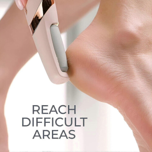 Flawless Pedi Electronic File & Callus Remover, Pedicure Tool 2