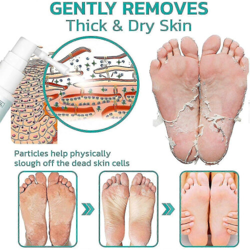 5g Professional Callus Remover Extra Strength Spray, Instant Foot Peeling Spray 1