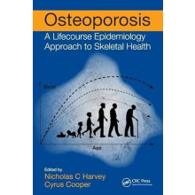 Osteoporosis Paperback Book