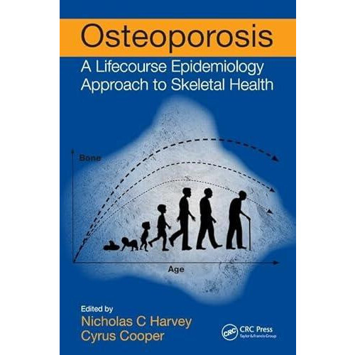 Osteoporosis Paperback Book