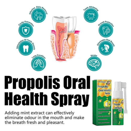 Propolis Oral Spray - Whitens Teeth