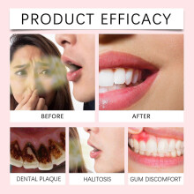 Oralhoe Probiotic Oral Freshener White Peach Probiotics for Oral Care And Fresh Breath Spray