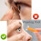 Transportable Scleral Lens Insertion Device Ventless Owner Smooth Elastomer Building 7